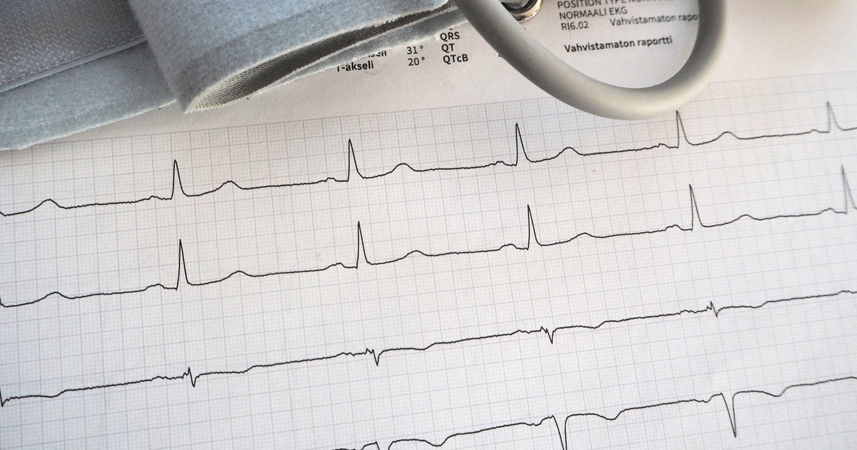 ET – Blogit | Tietyssä iässä – Käyttäjäkokemus: Amlodipin 5 mg lopetti ...
