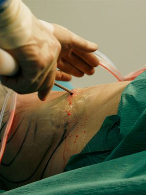 Tämä on kuvituskuva eikä liity Mairen tapaukseen.