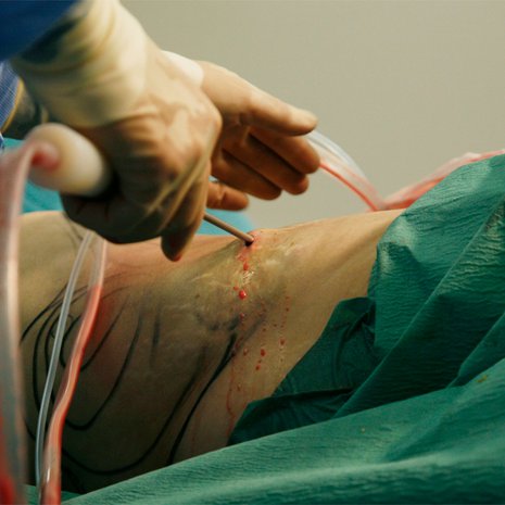 Tämä on kuvituskuva eikä liity Mairen tapaukseen.