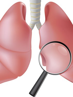 Kuva: <span class="photographer">123RF</span>